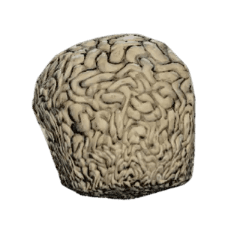 Brain Bombs