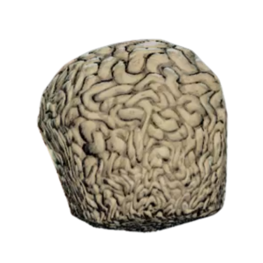 Brain Bombs